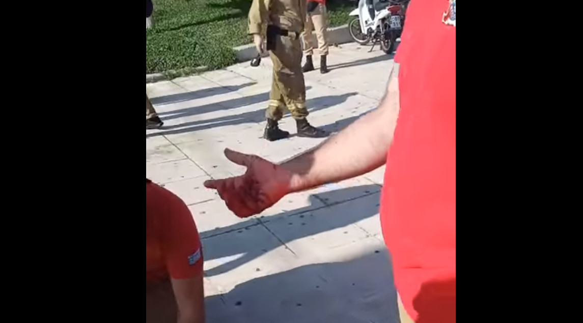 Σοκαριστικό βίντεο από τον τραυματισμό του πυροσβέστη διαδηλωτή